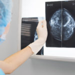 Better Breast Cancer Surgery? | Cancer | Andrew Weil, M.D.