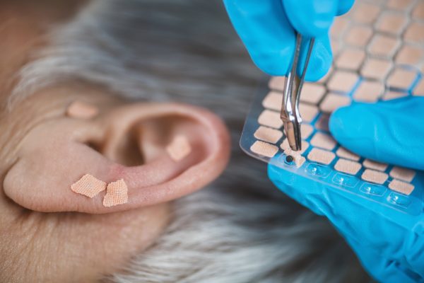 Are Ear Seeds Worthwhile? | Wellness Therapies | Andrew Weil, M.D.
