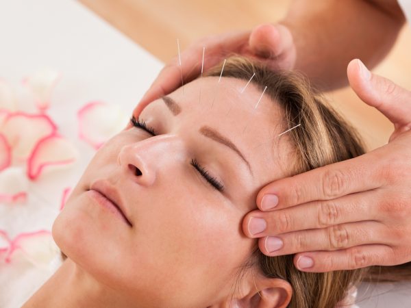 Acupuncture For Migraines? | Headaches | Andrew Weil, M.D.