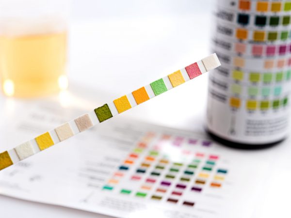 Do I Need To Monitor My Uric Acid Levels? | Disease &amp; Disorders | Andrew Weil, M.D.